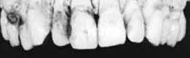 Victim's Dental X-ray