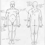 The Doe Network: Case File 1087UMKY 
