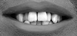 Teeth