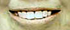 teeth