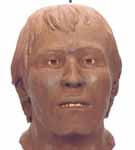 front view of victim