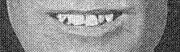 dentals