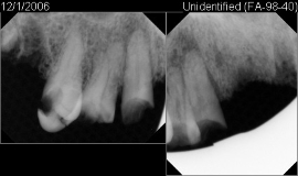 xray