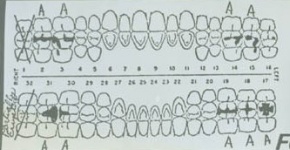 Dentals