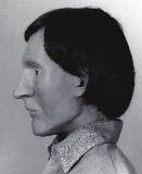 Reconstruction