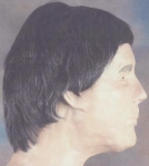 unidentified decedent