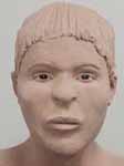 Wesley Neville reconstruction