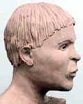 Wesley Neville reconstruction