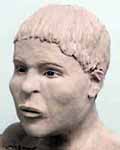 Wesley Neville reconstruction