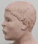 Wesley Neville reconstruction